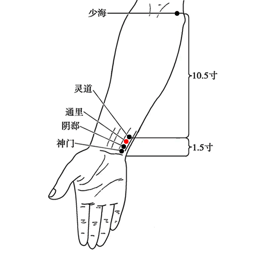 通里穴