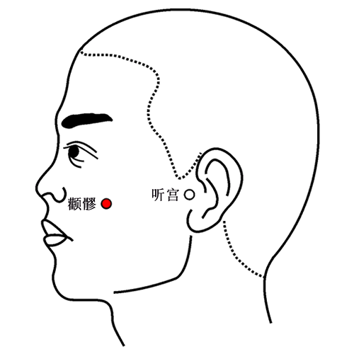 颧髎穴