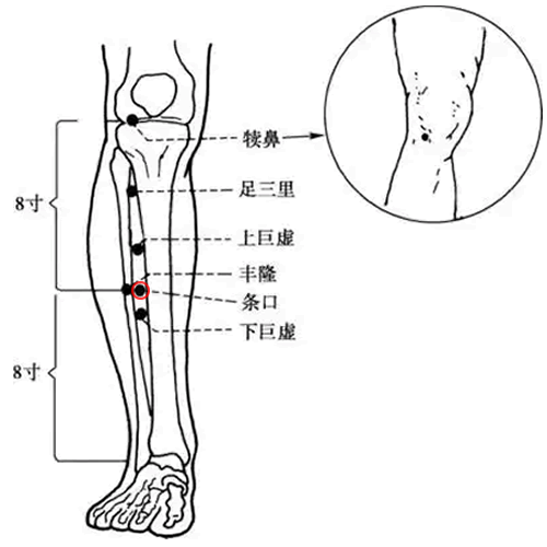 条口穴