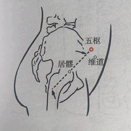 五枢穴