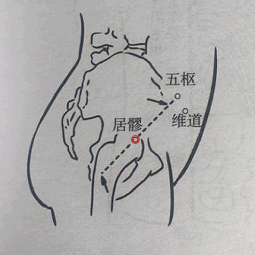 居髎穴