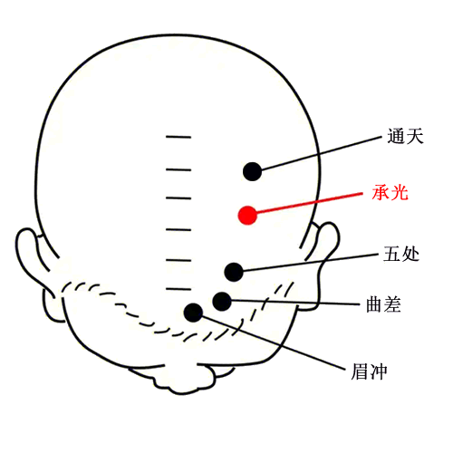 承光穴