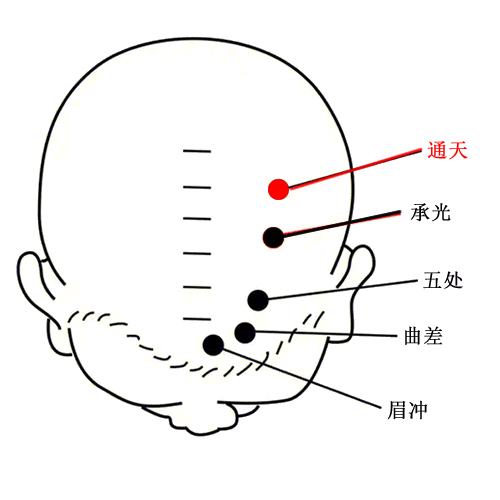 通天穴