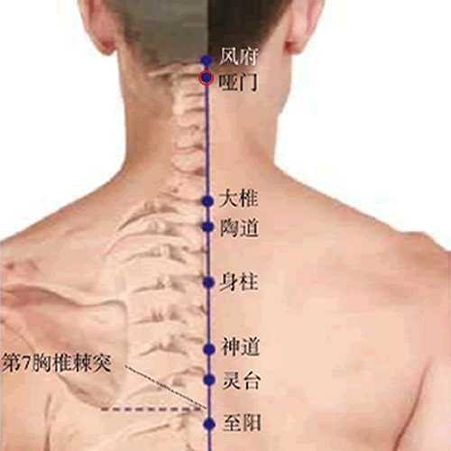 哑门穴