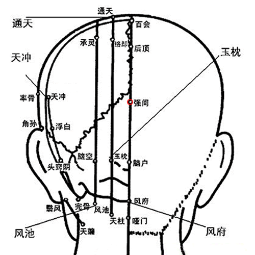 强间穴