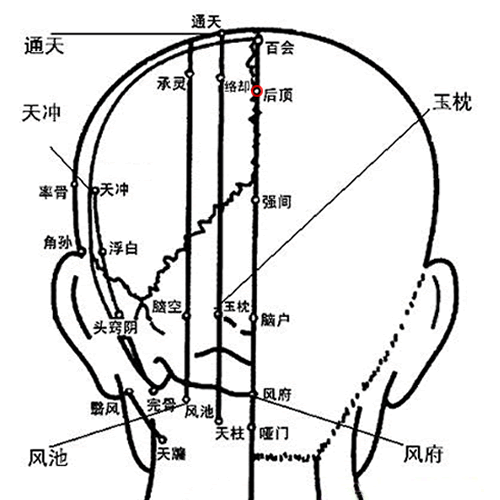 后顶穴