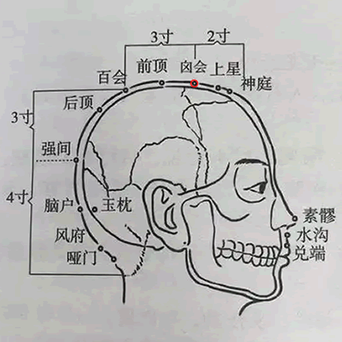 囟会穴