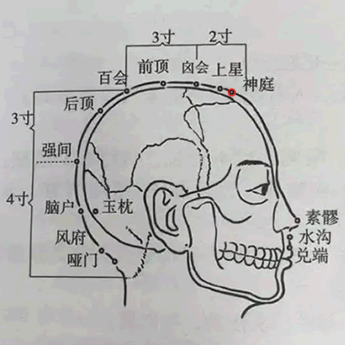 神庭穴