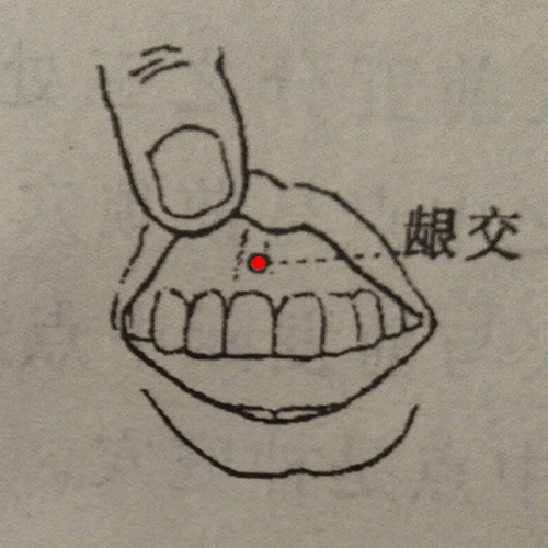 龈交穴