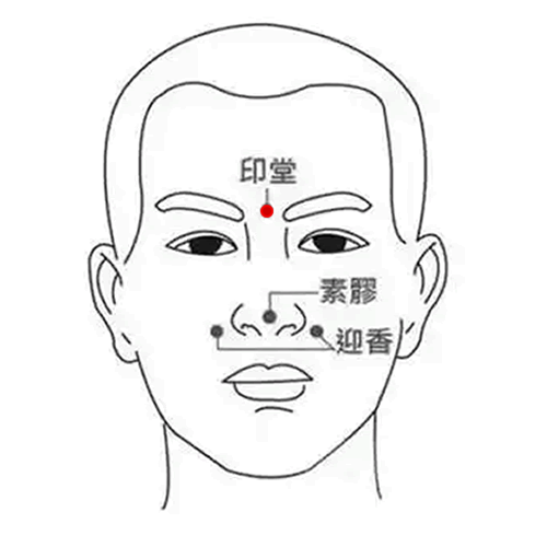 印堂穴